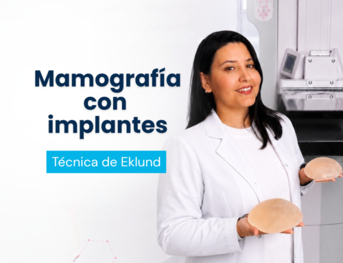Mamografía con implantes